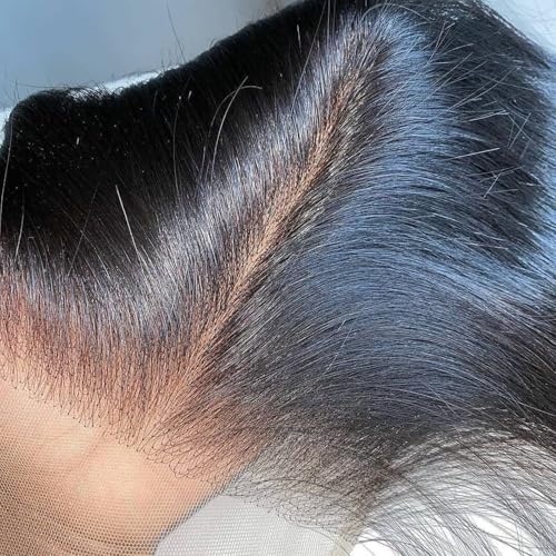 VINOVILLO 5x5 Skinlike HD Lace Closure