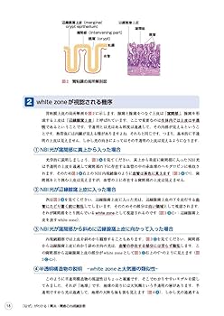 ２ｃがわかる８０例 早期胃癌診断のエッセンス/医学書院/中野浩（単行本） 2cがわかる80例 早期胃癌診断のエッセンス/医学書院/中野浩