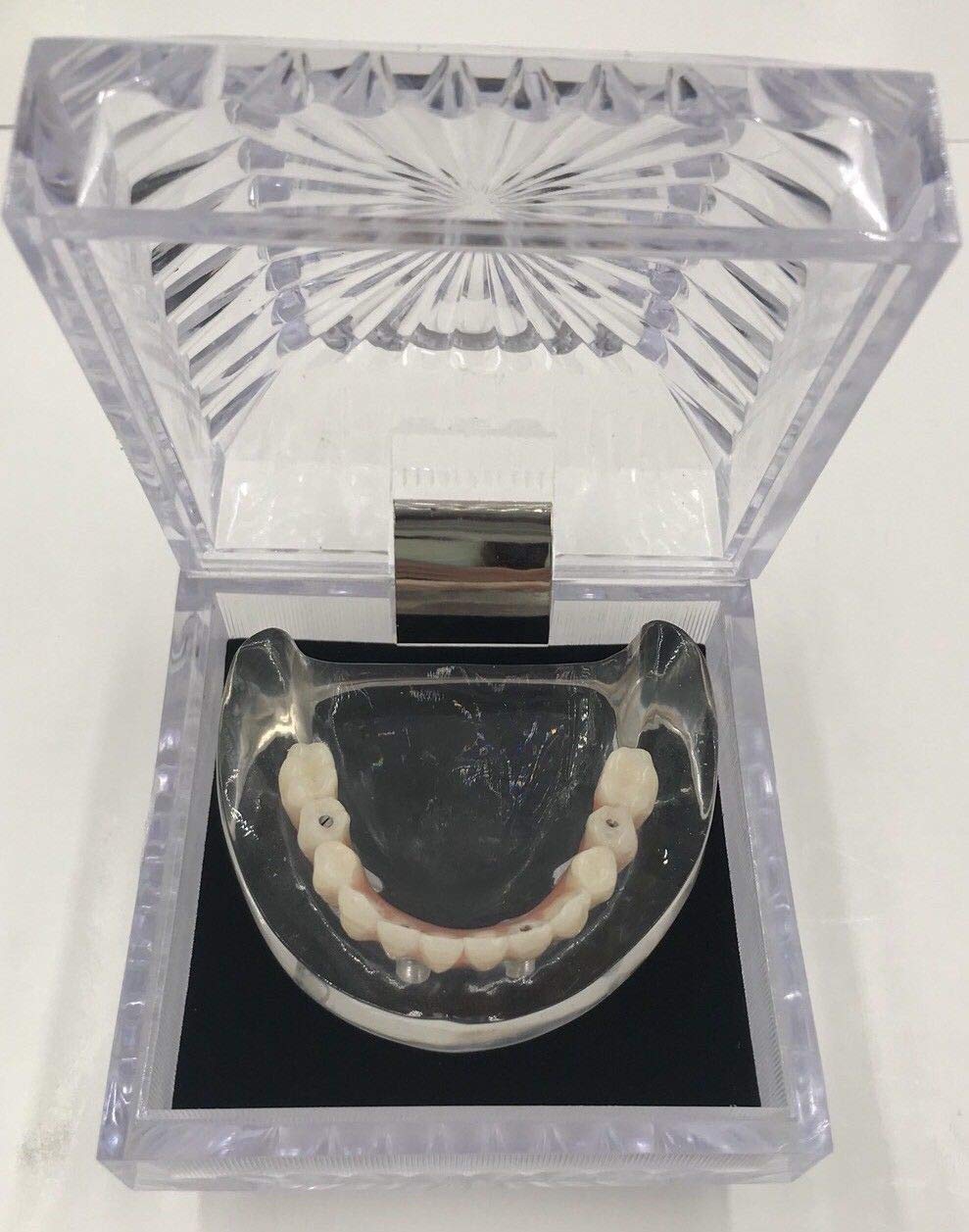 Kilgore Dental Over Denture Lower Mandible Model LH4 (All