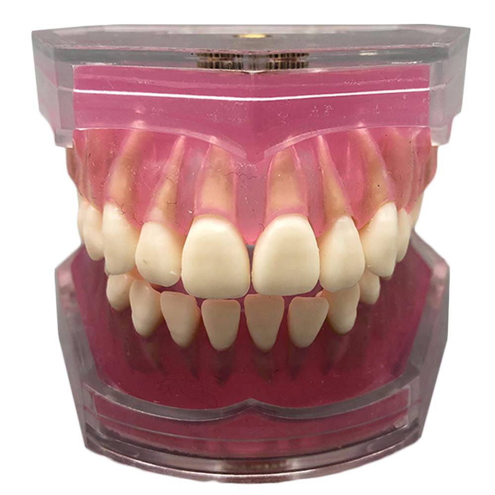 Sjdopulse Transparent Dental Implant Teeth Model - Teeth Teaching Model With 28 Pcs All Removable Teeth - Teeth Model For Education - Teeth Demonstration Model For Study Display (Transparent)