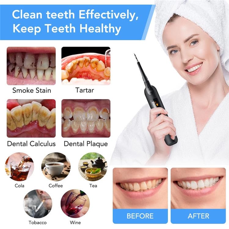 HANNEA® Teeth Cleaning Kit Plaque Remover for Teeth, 5 Modes, Rechargeable 4