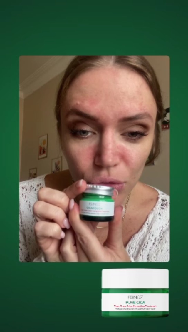 Amazon.com: Sinoz Pure Cica Tiger Grass Color Correcting Repair