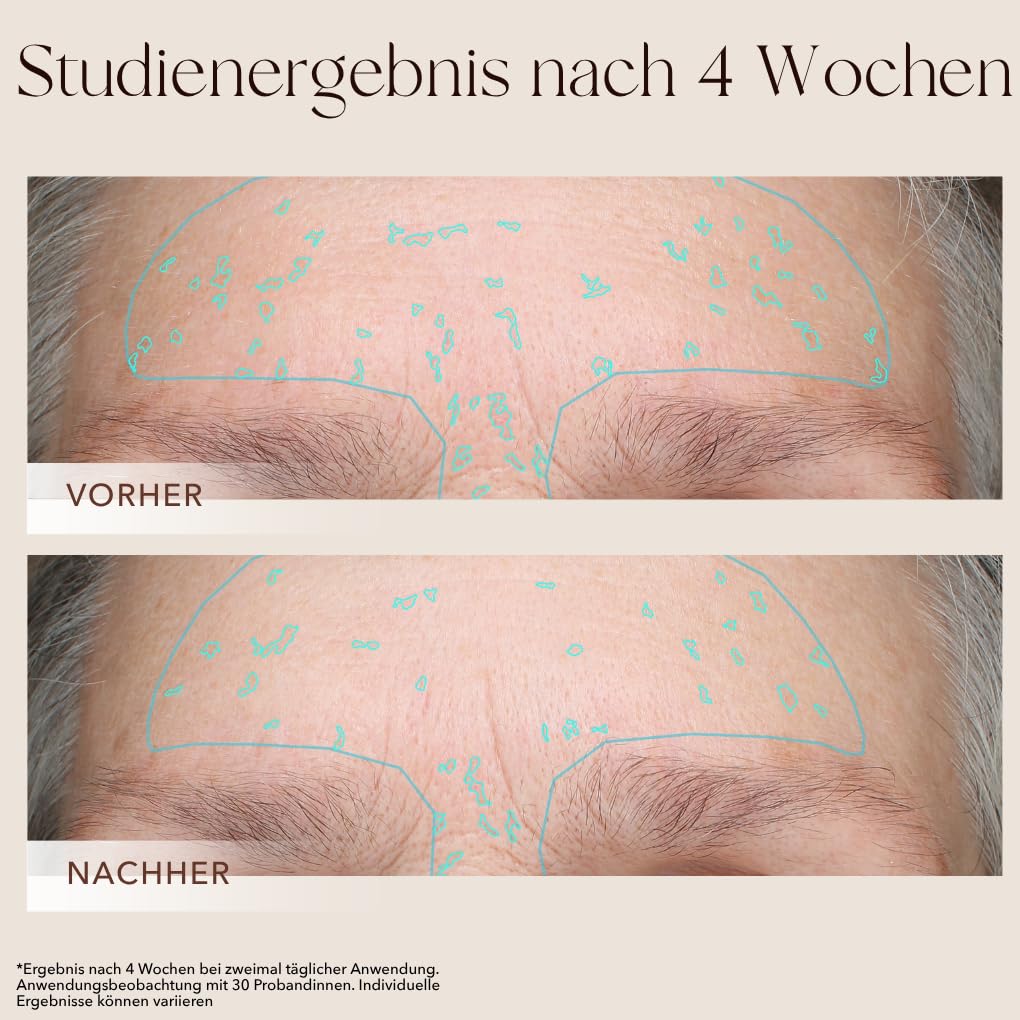 mellow NOIR XTREME Brightening Booster 30ml - Anti Pigmentflecken Serum - Reduziert dunkle Flecken, Altersflecken & Pickelmale im Gesicht und auf der Haut - Vegan - Zertifizierte Naturkosmetik