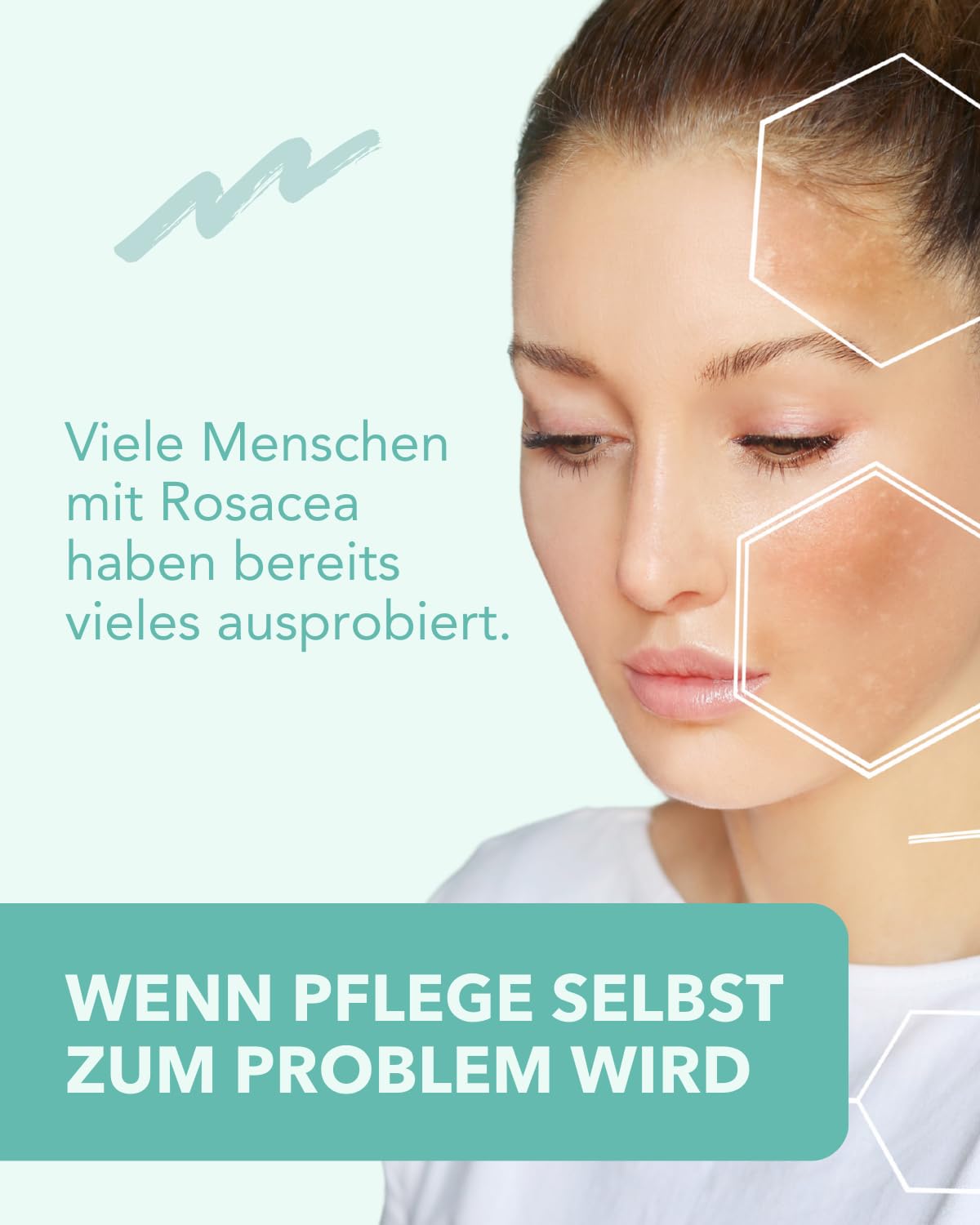 DemoDerm Rosacea Creme 30 g – wasserfreie Pflege | Für zu Rosacea neigende, empfindliche Haut | Mit Zink, Schwefel & Silber | Sehr ergiebig | Made in Germany