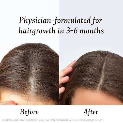 Miniatura 4 de Suplemento para el crecimiento del cabello para mujeres, promueve un cabello más grueso, más lleno y más fuerte, con biotina, extracto de hierbas,