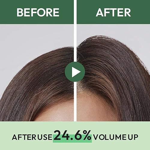 Miniatura 7 de AMOS PROFESSIONAL The Green Tea Shampoo Refresh [para cuero cabelludo graso] 17.6oz (500g) | Champú coreano para el crecimiento del cabello contra