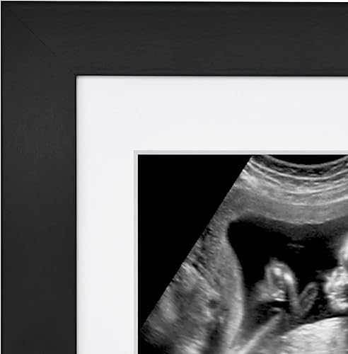 Miniatura 7 de Americanflat Sonogram - Marco de fotos con vidrio inastillable, marco de ultrasonido de 7 x 7 pulgadas para ecografías de 3 x 4 con alfombrillas