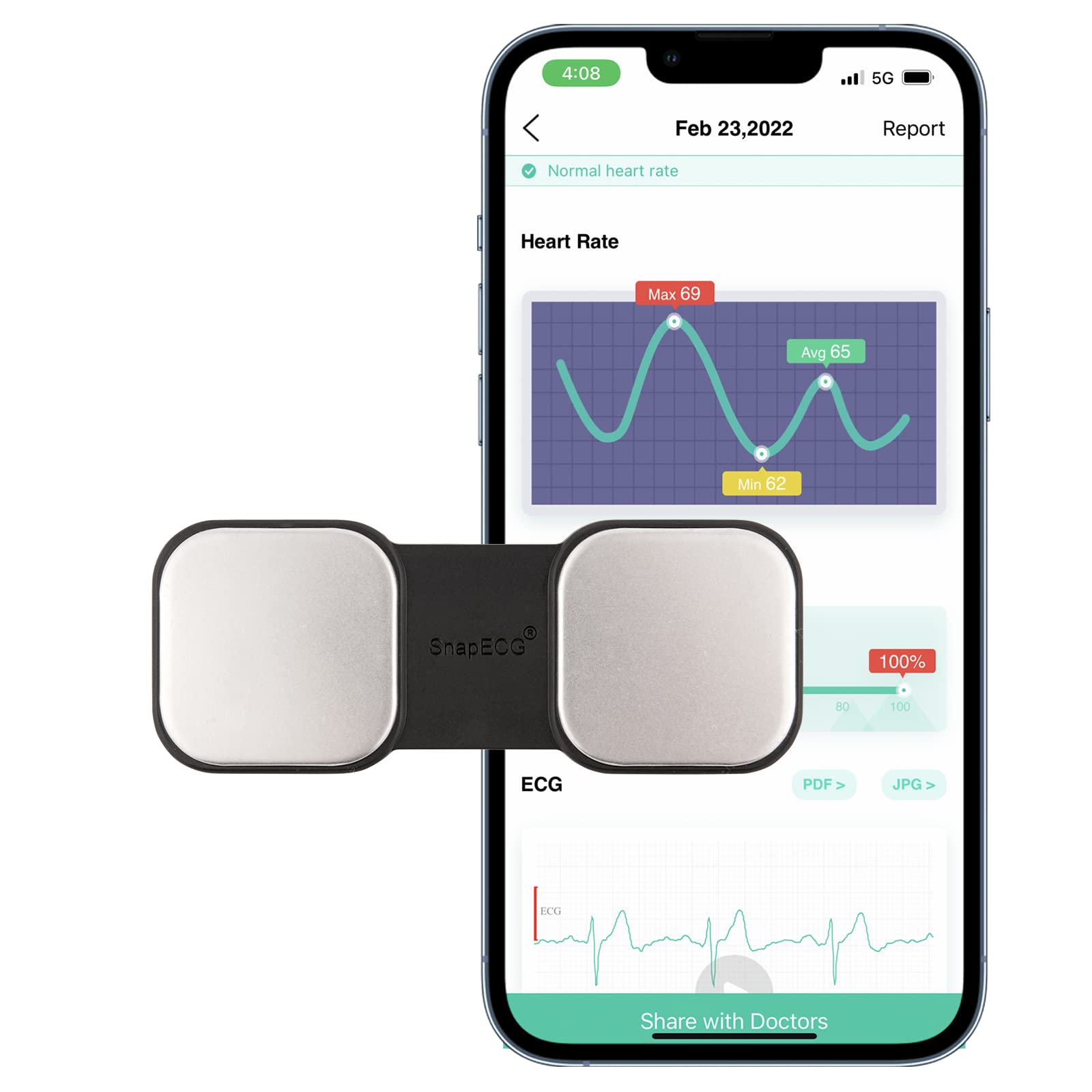 RAVFLOW SnapECG Bluetooth EKG/ECG Monitor, Record ECG & Heart Rate at
