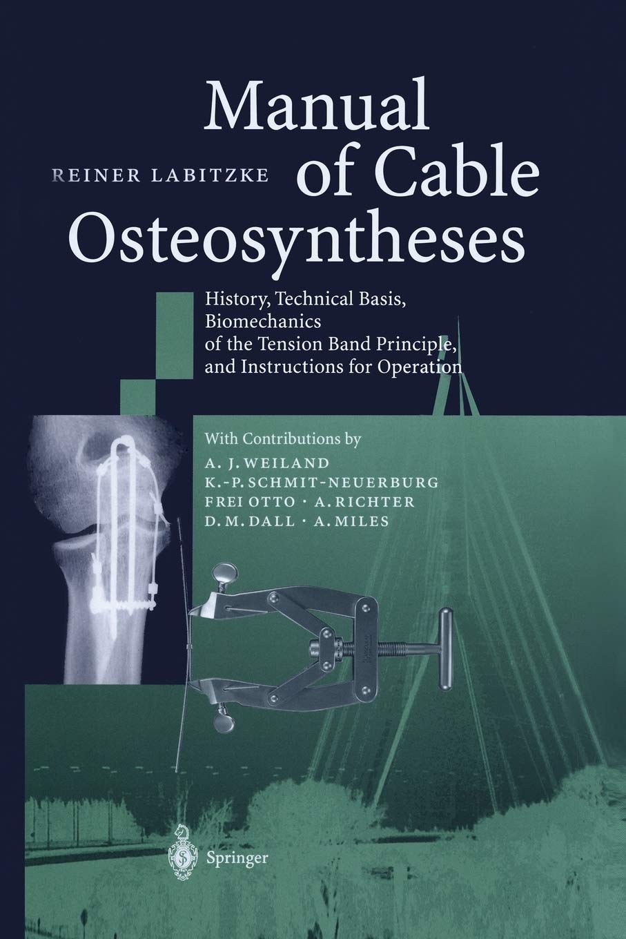 Manual of Cable Osteosyntheses: History, Technical Basis, Biomechanics of the Tension Band Principle, and Instructions for Operation