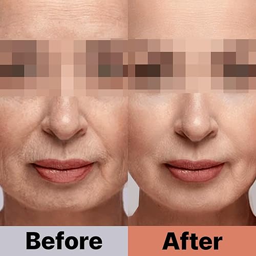 Miniatura 3 de Tween.Ty Skin Crema de apriete prémium