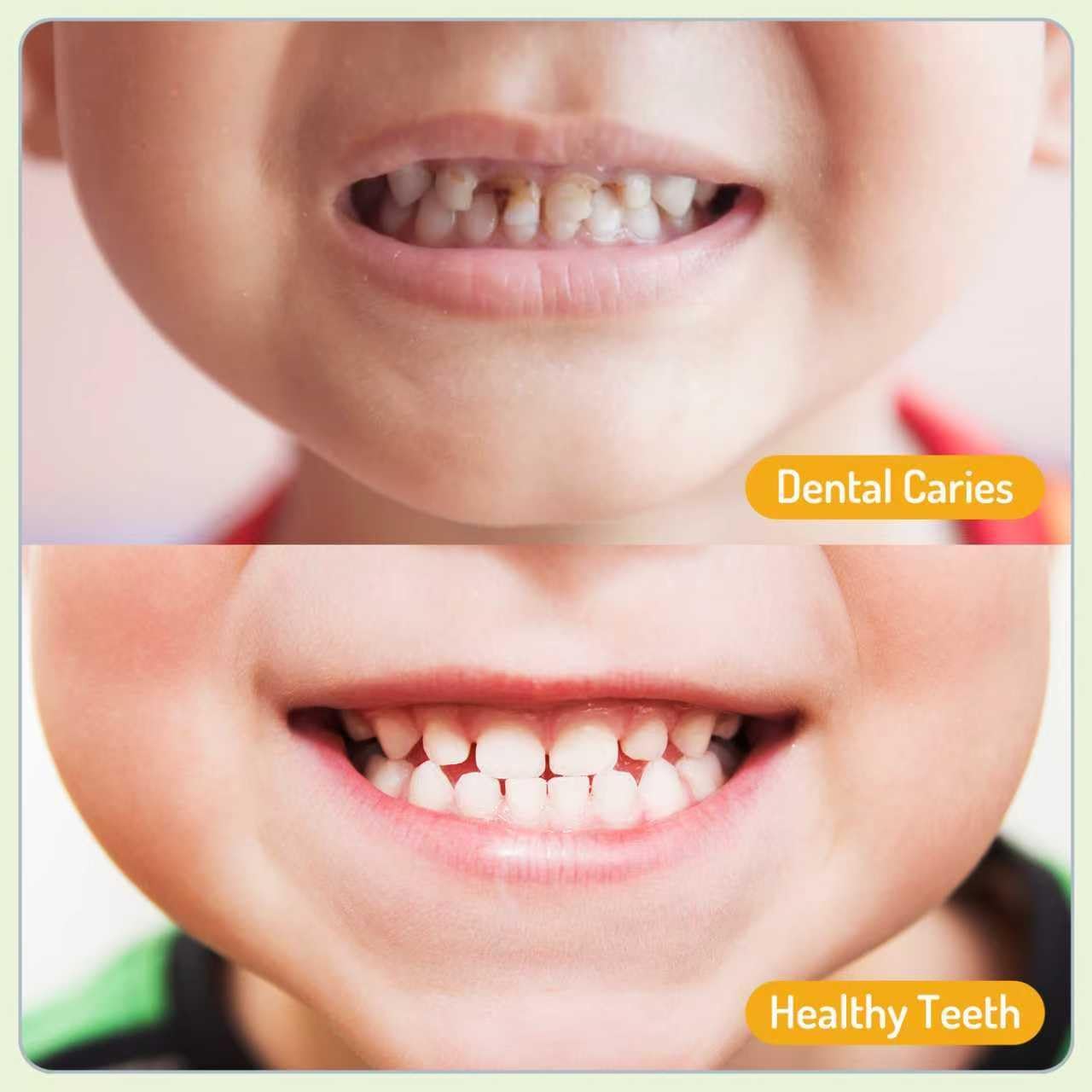 Oral Spray for Children, Cleans Teeth Gently, Freshens Breath Instantly