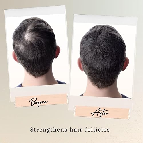 Miniatura 4 de Suero para el crecimiento del cabello con vitamina E, cúrcuma y aceite de argán, tratamiento orgánico para el cuero cabelludo seco para mujeres,