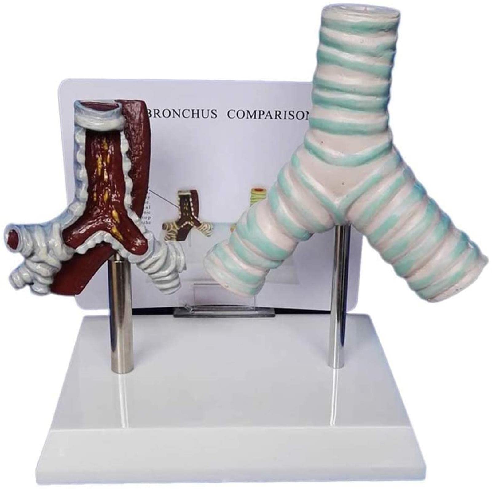 Educational Trachea Model Comparative Smoking Trachea And Normal Tracheai Anatomy Study Model Human Organ Anatomical Model Visceral Trachea Model