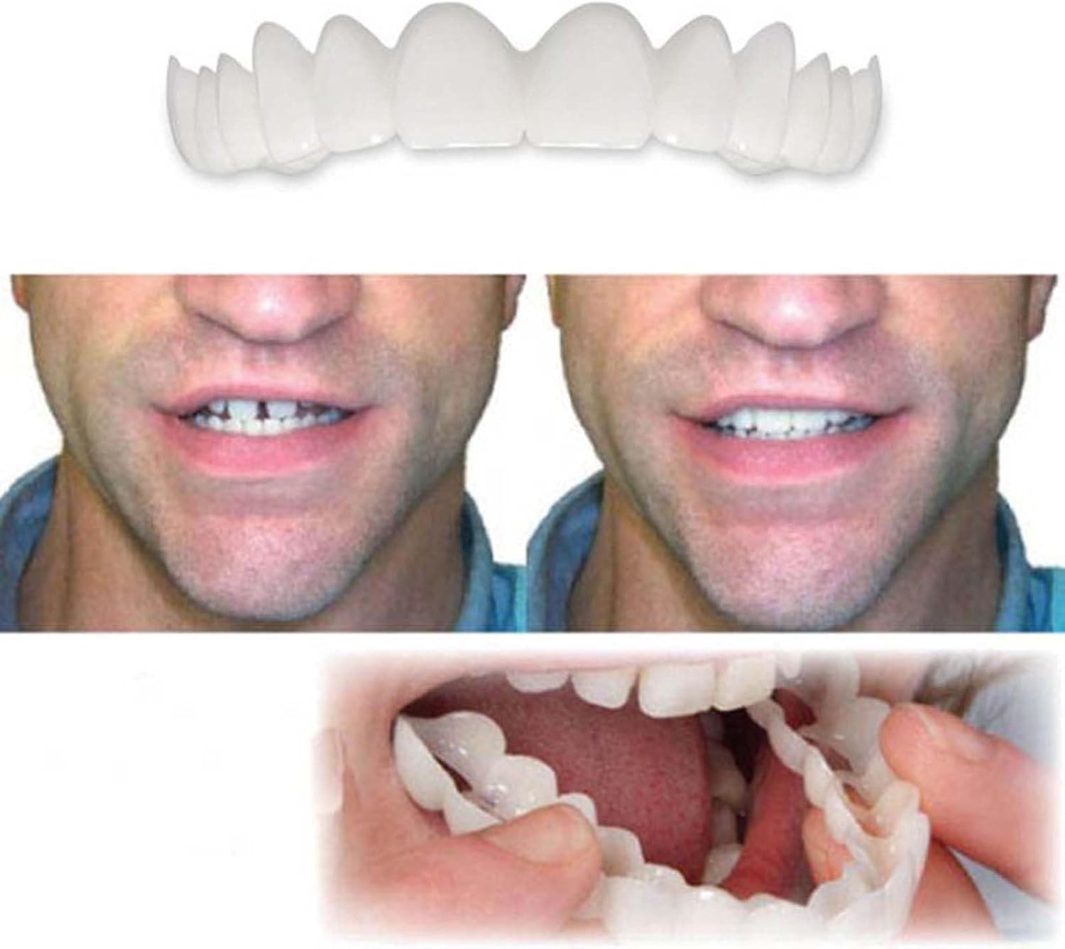2 Pairs, Regain Confidence Smile for Women and Men, Temporarily Adjustable (1)