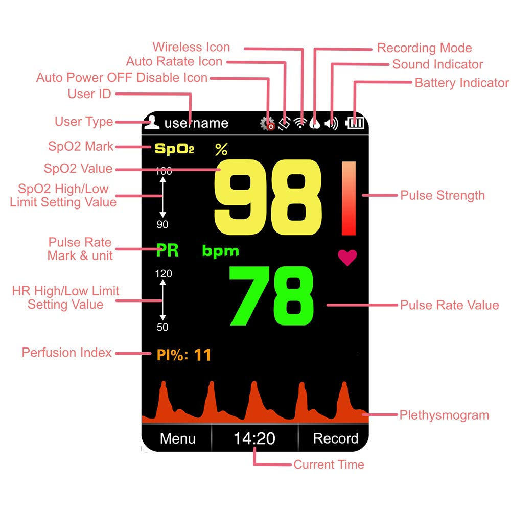 Buy Viatom Handheld Pulse Oximeter for Adults, Up to 580 Hours of