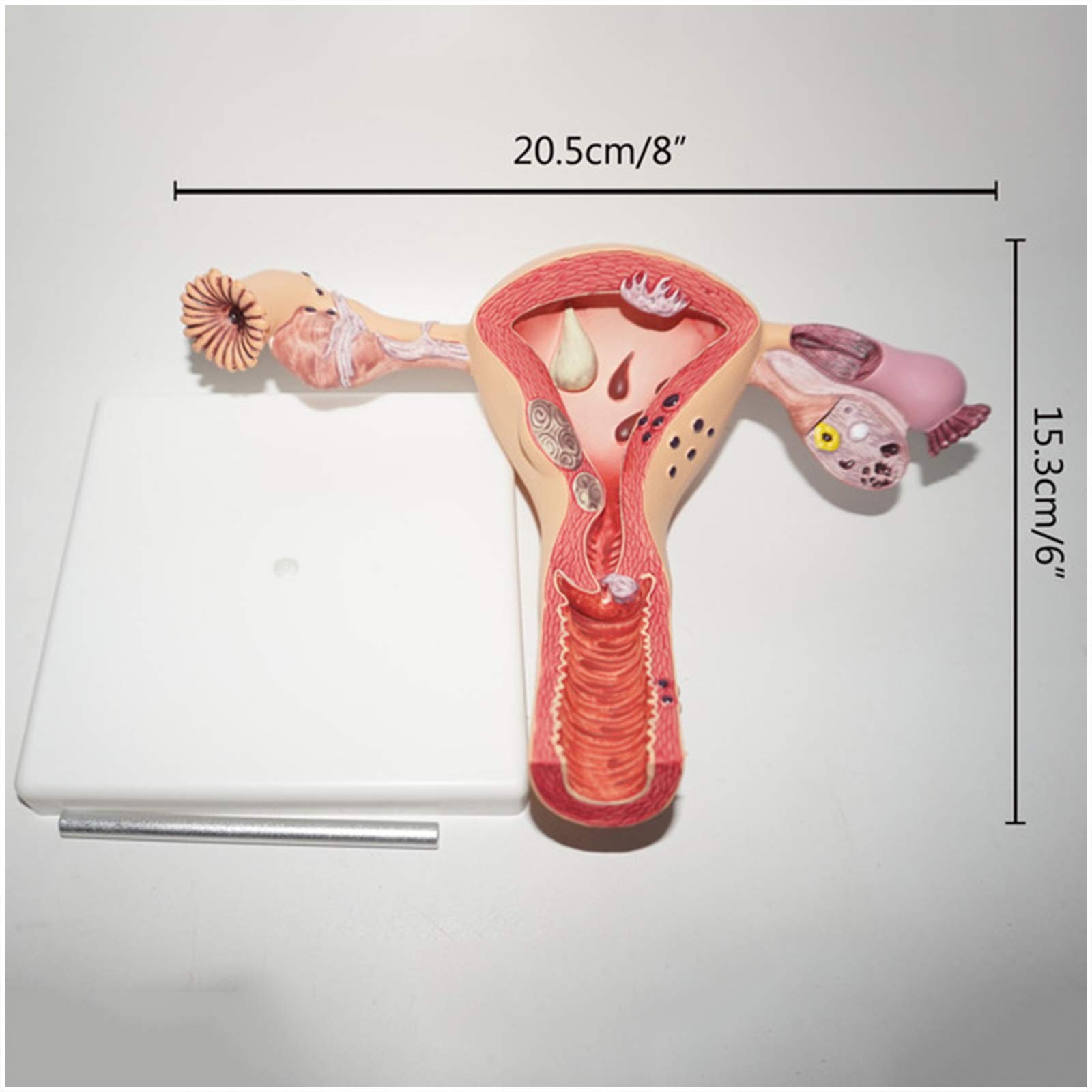 Suzlazyr Uterus And Ovary Model Female Reproductive Organ Model Human, image size:1600x1600