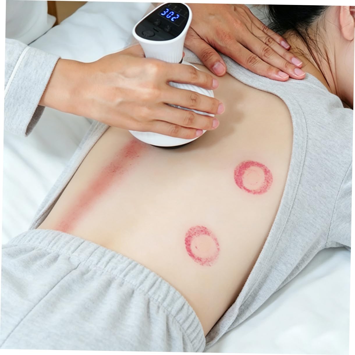 Masajeador Electrónico de Raspado Corporal Terapia de Ventosas