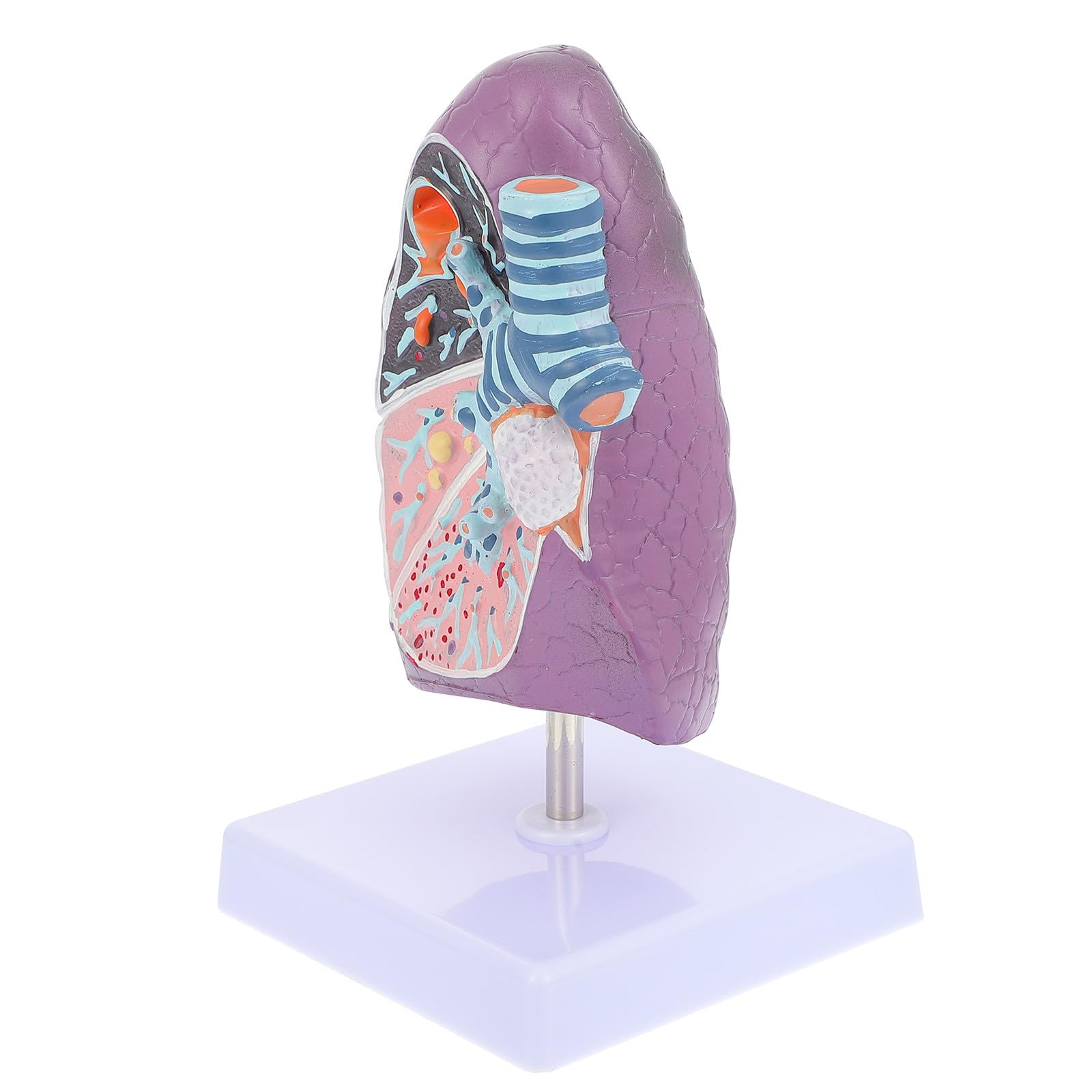 Outil Pédagogique de L'anatomie Physiologie pour Enseignement en Plastique Modèle Pulmonaire Pathologique Réaliste pour Étudiants en Sciences Médicales