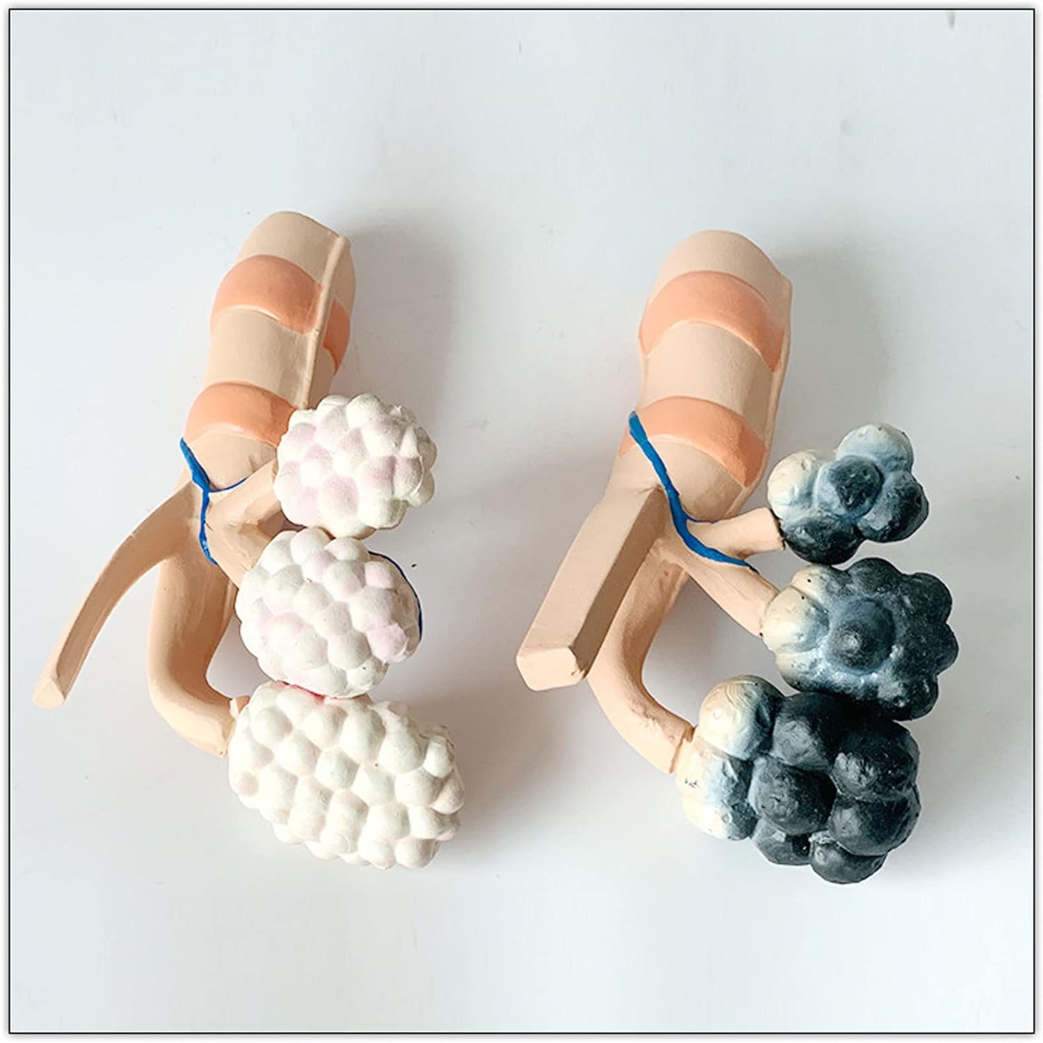Modèle alvéolaire de la santé pulmonaire chez le fumeur, modèle de poumon sain, avec caractéristiques pathologiques et structure anatomique précise pour les effets du tabagisme sur la santé pulmonaire
