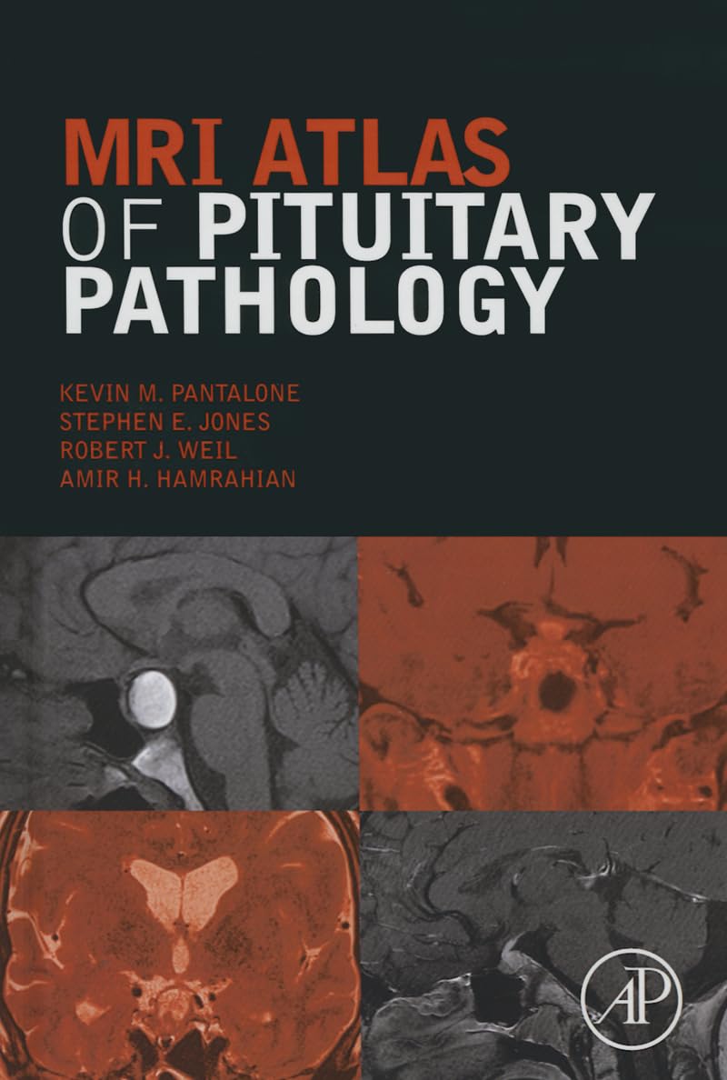 MRI Atlas of Pituitary Pathology Pantalone Jones Weil Hamrahian Hardback