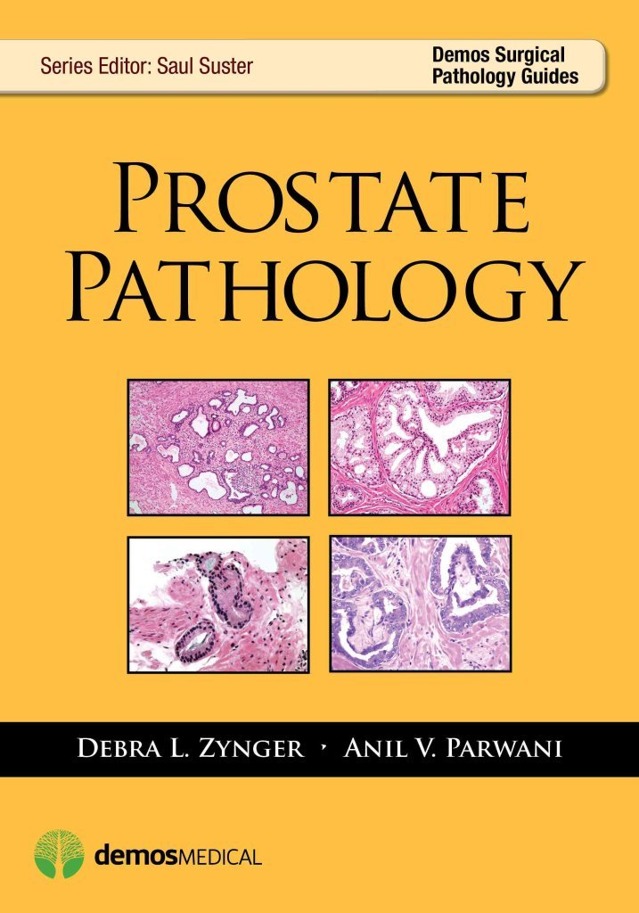 [(Prostate Pathology)] [Edited by Debra L. Zynger ] published on (August, 2014)