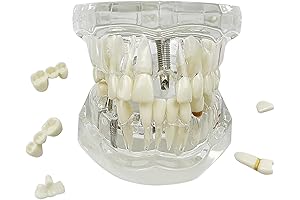 YOUYA DENTAL Transparent Implant Teeth Model