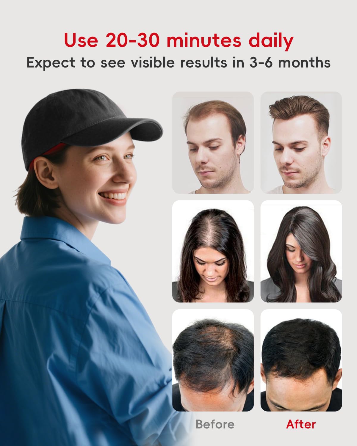Casque laser à lumière rouge pour la perte de cheveux–Casque laser LLLT avec 660, 850 et 940 nm+impulsion infrarouge–Casque de croissance capillaire pour hommes et femmes,soulagement de la douleur