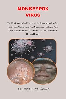 MONKEYPOX VIRUS: The Key Facts And All You Need To Know About the Virus; Causes, Signs And Symptoms, Treatment And Vaccine, Transmission, Prevention And The Outbreaks In Human History