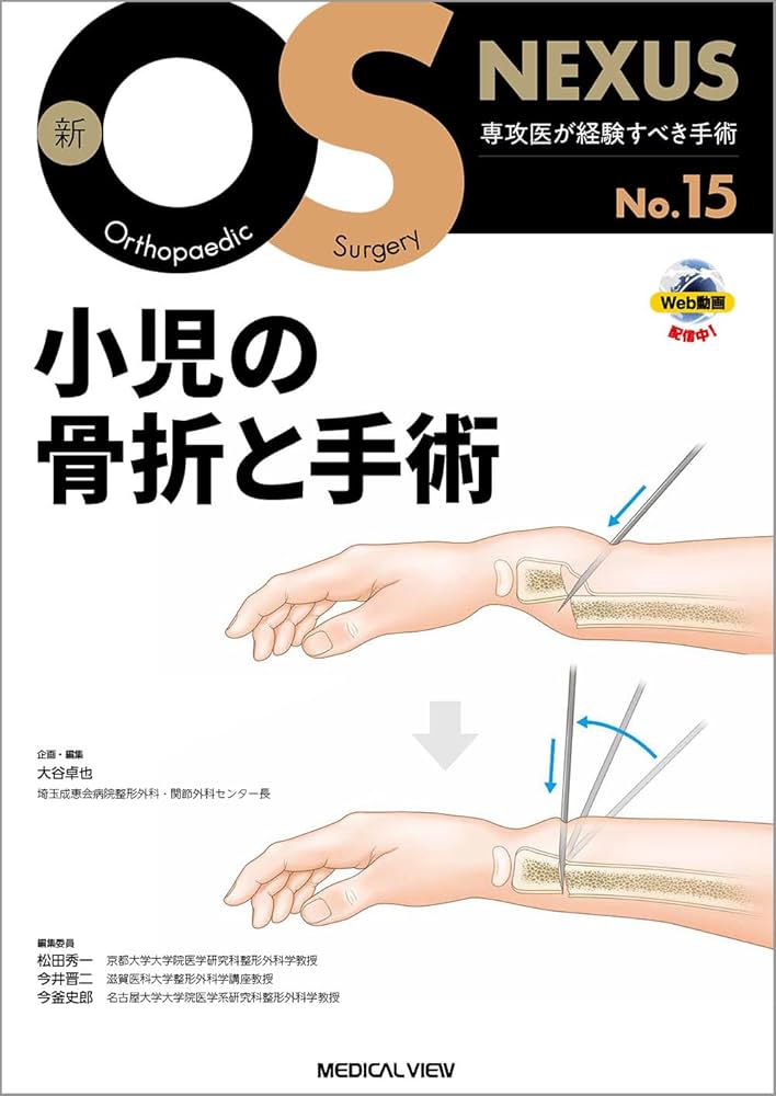 小児の骨折と手術［Web動画付］ (新OS NEXUS) | 大谷 卓也 |本