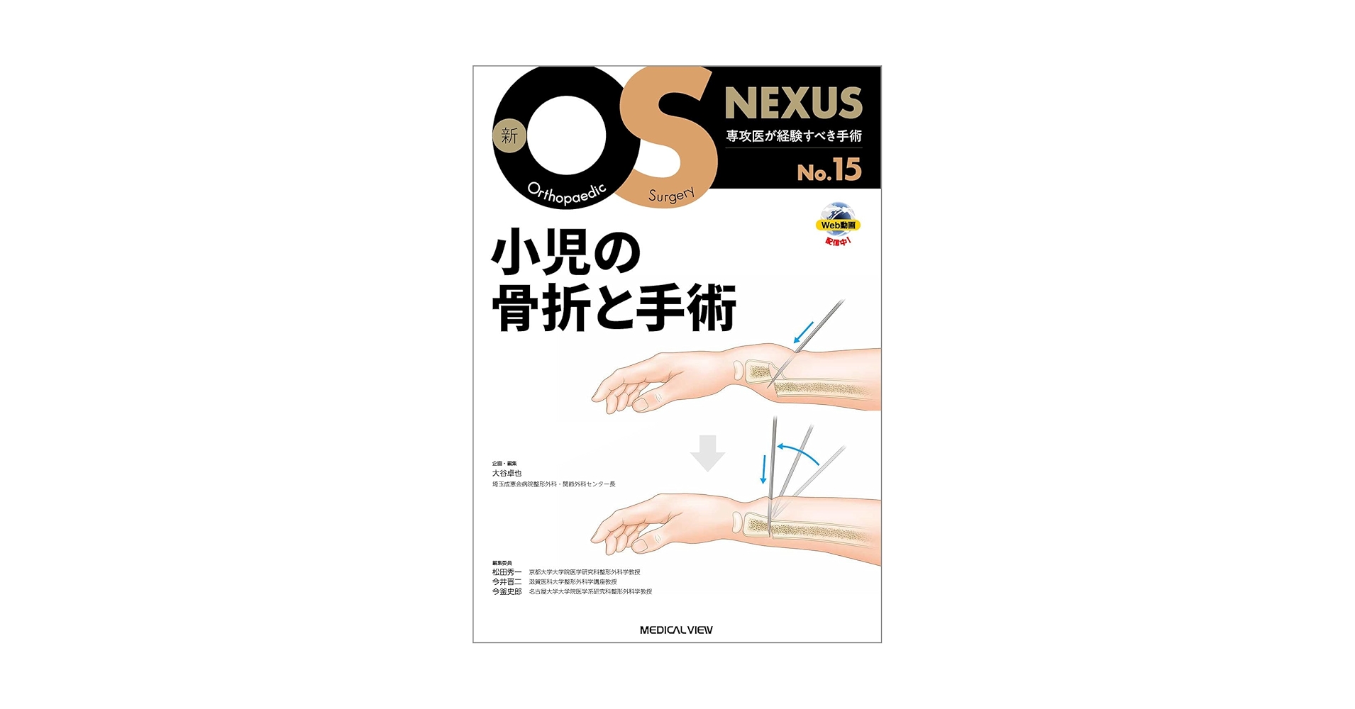 新OS NEXUS No.15 小児の骨折と手術 小児の骨折と手術［Web動画付］ (新OS NEXUS) | 大谷 卓也 |本