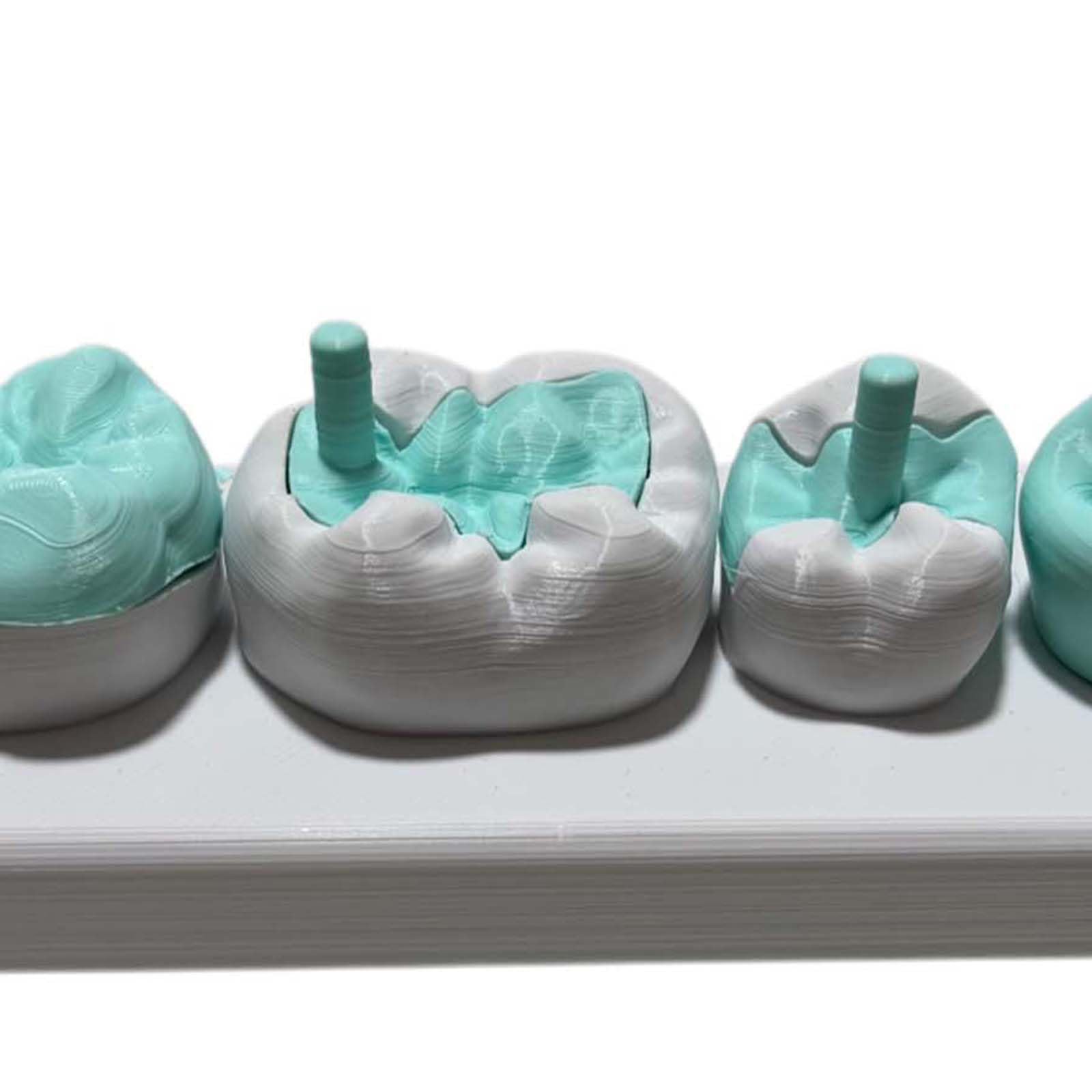 Modello di Intarsio e Onlay, Modello Didattico di Corona Completa con Attacco Magnetico, per la Comunicazione Dentista-Paziente