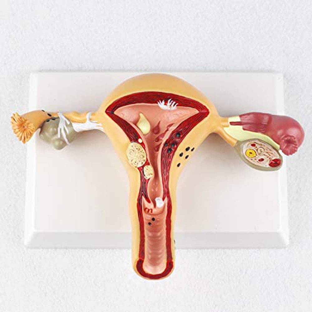 sjdoPulse Human Organ Model Female Reproductive Pathology, Uterine Model, Vaginal Ovarian Model,normal uterus (Pathological Uterus 1)