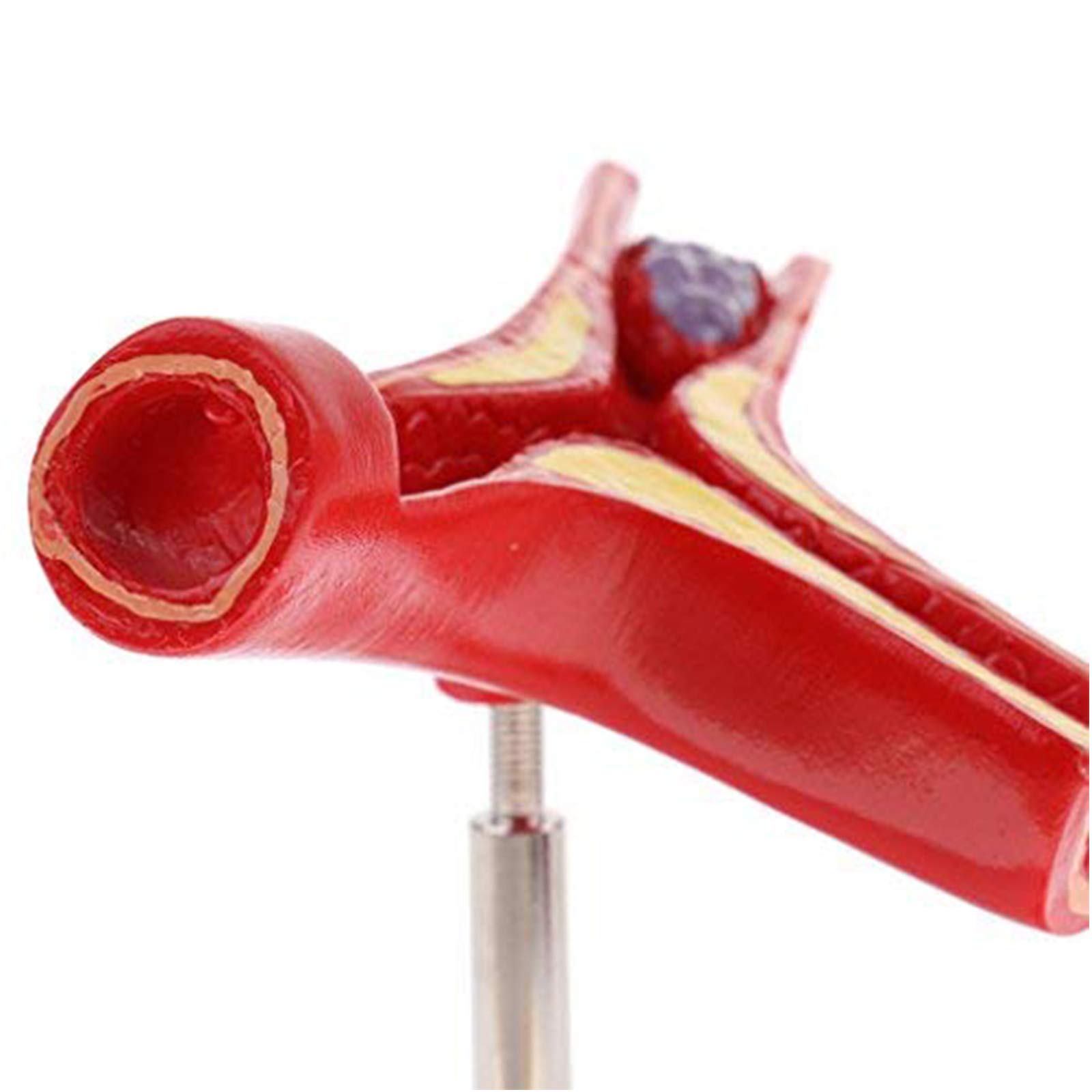 Model układu sercowo-naczyniowego ludzkiej miażdżycy, model anatomiczny naczyń krwionośnych, model skrzepliny do medycznych materiałów dydaktycznych