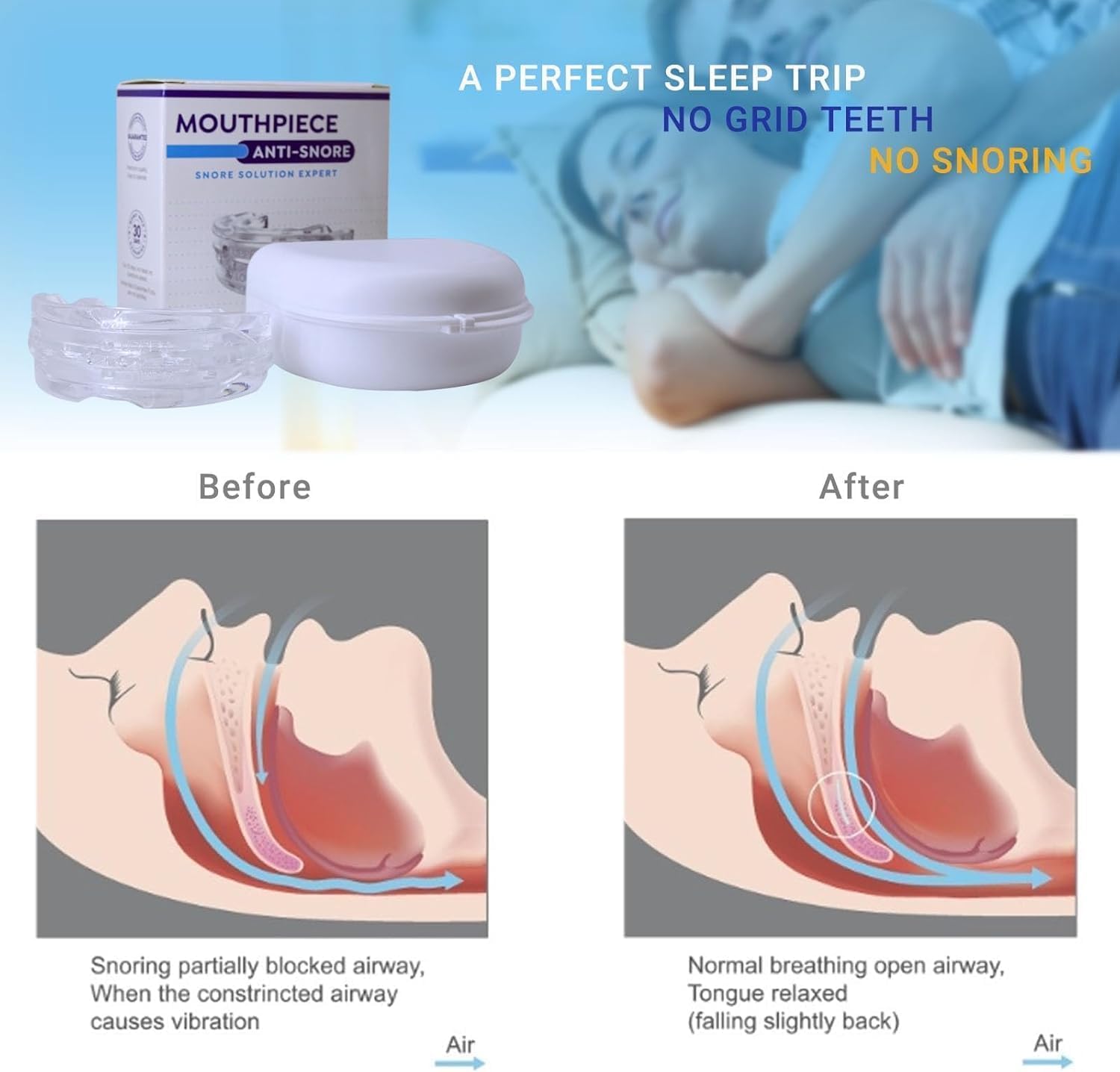 Sofela AirFlow,AirFlow Anti Ronflement Avis- Anti Ronflement Efficace Puissant (Bleu)