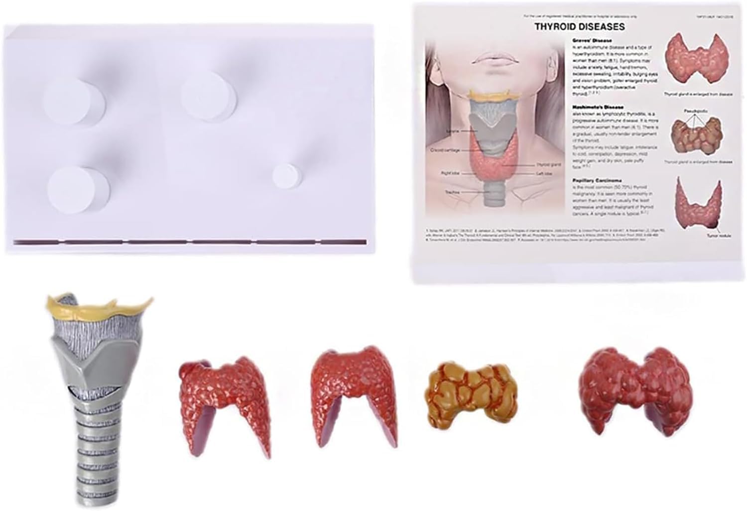 Modèle de glande thyroïde humaine, modèle d'anatomie normale et pathologique de la thyroïde humaine, échelle 3:1, illustrant le système digestif pathologique de la thyroïde. Modèle d'étude anatomique