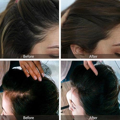Miniatura 7 de Polvo de retoque de raíz, polvo de cabello al instante para adelgazar la línea capilar para cubrir la línea capilar y oculta la pérdida de cabello,