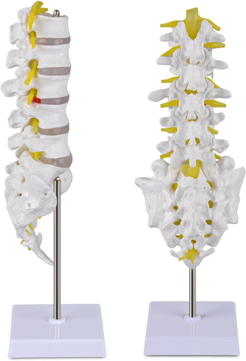 Ultrassist Human Lumbar Spine Model, Lumbar Vertebrae Anatomy Model with Herniation Discs, Lumbar Nerves and Spinal Cord for Medical Student Study Teaching