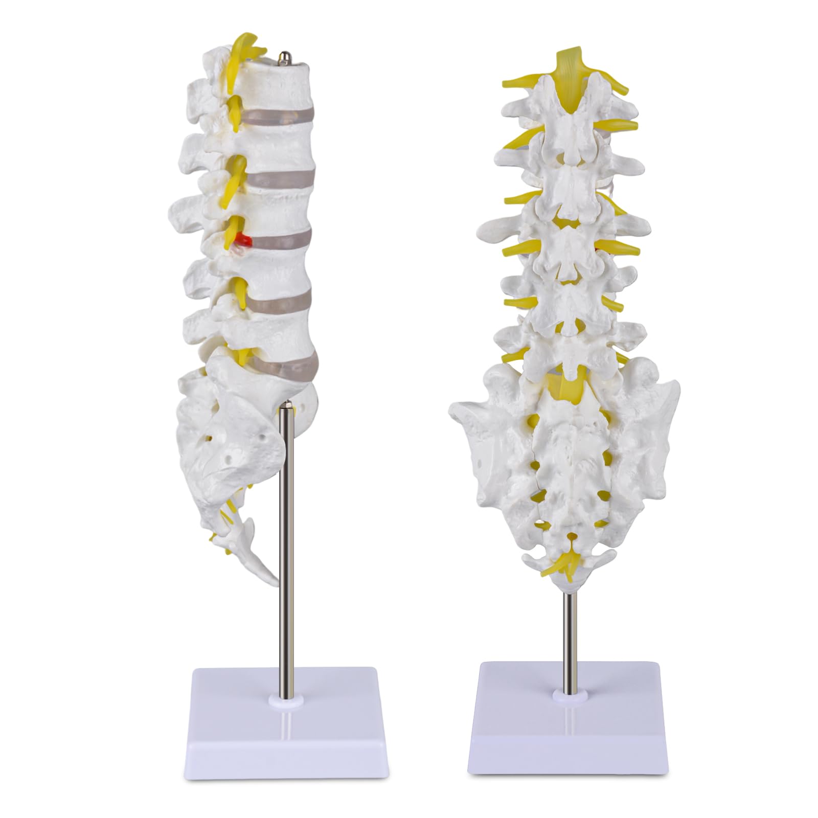 Ultrassist Human Lumbar Spine Model, Lumbar Vertebrae Anatomy Model with Herniation Discs, Lumbar Nerves and Spinal Cord for Medical Student Study Teaching