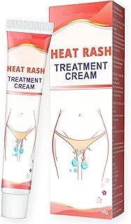20g Heat Rash Treatment Cream, Heat Rash Cream, Heat Rash Care Cream, Fast Relief from Sweat Rash, Dry, Itchy, Bite, Rash, Irritated Skin (1pcs)