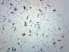 EISCO 10PK Mixed Diatoms, Wholemount - Prepared Microscope Slides - Classroom Pack, 10 Slides in Storage Case - Biology & Microscopy