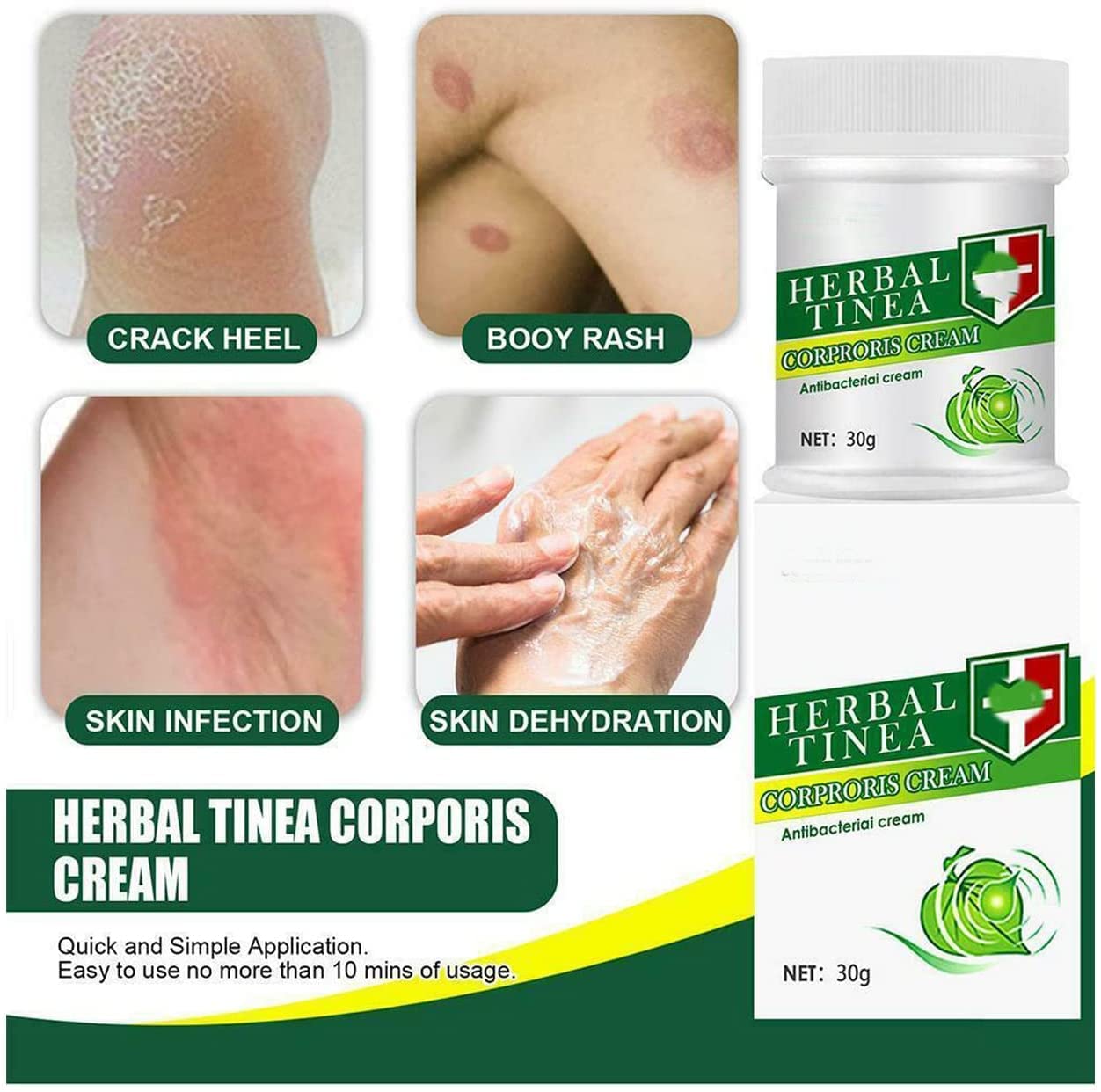 ZUYOKI Herbal Tinea Corporis Cream Tinea Skin Relief Itching Cream