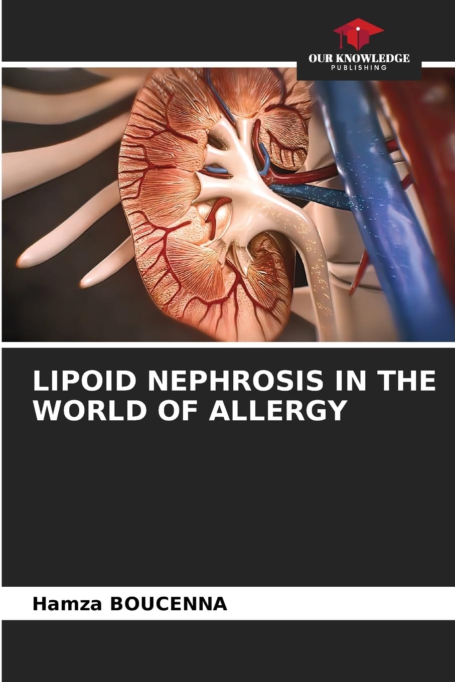 LIPOID NEPHROSIS IN THE WORLD OF ALLERGY