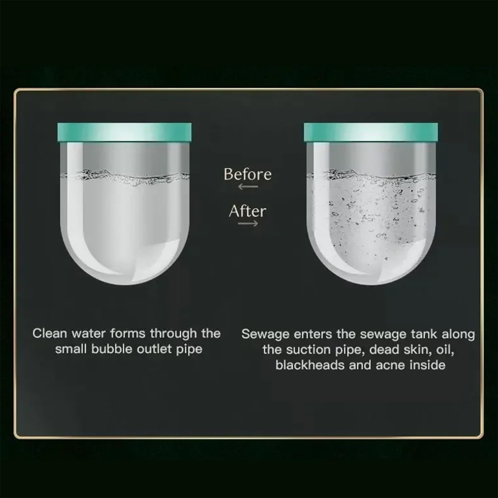 Strumento per iniezione di ossigeno a bolle piccole Hydra Dermoabrasione Aqua Peeling Dispositivo di bellezza Pulizia viso Aspirazione comedone,B