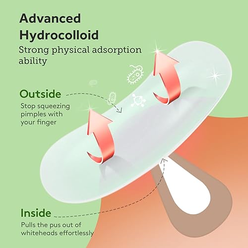 Miniatura 4 de Parches para espinillas (6 tamaños, 138 parches), parches de acné para brotes de acné grandes, vendajes hidrocoloides para cara, barbilla, nariz,