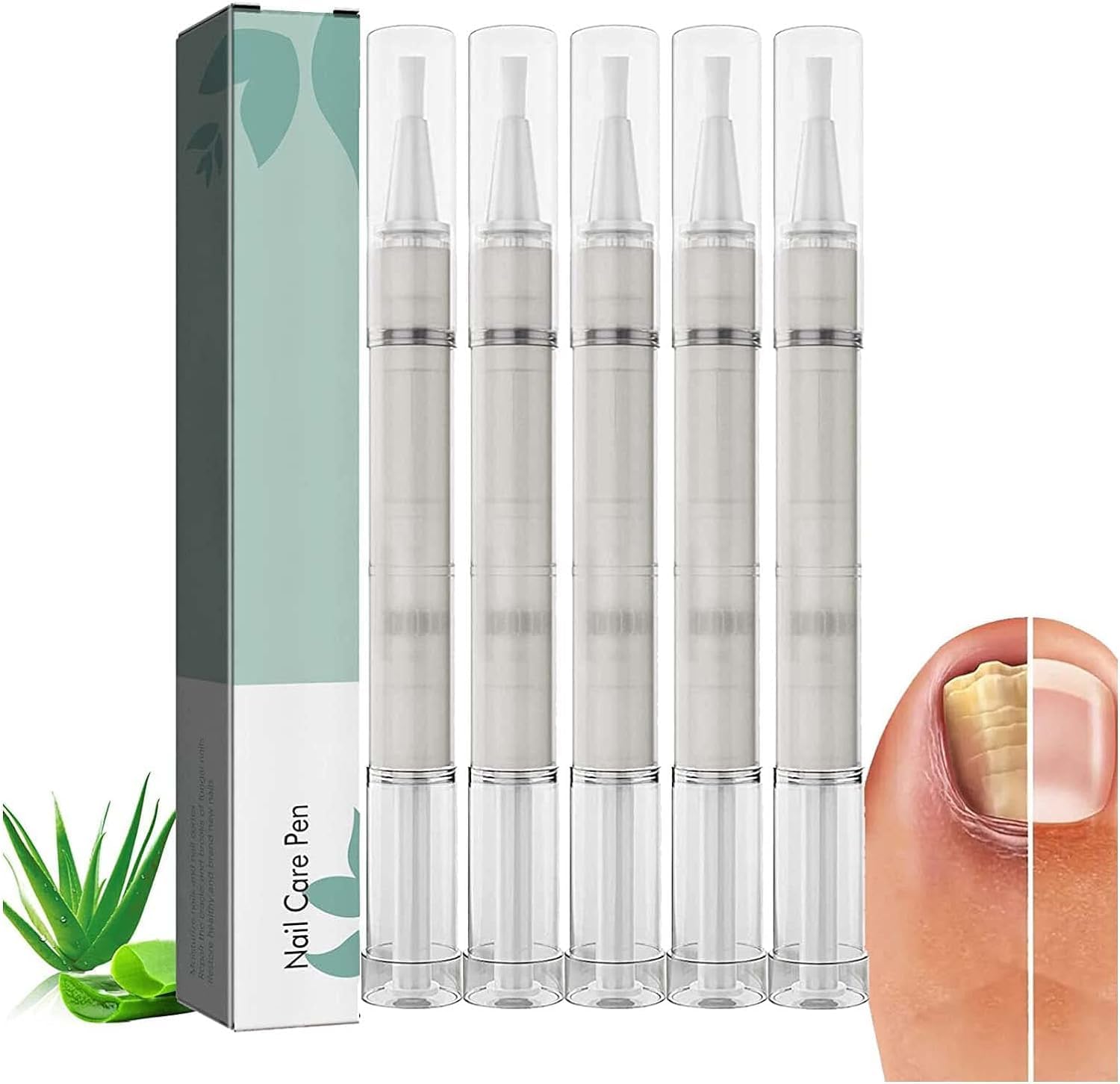Nail Care Pen, Nail Growth Serum, Nail Treatment Pen, Cuticle Oil For Nails, Nail Growth Treatment, Growth Treatment Nourishment Cuticles, Foot Care Repair (white5Pcs)