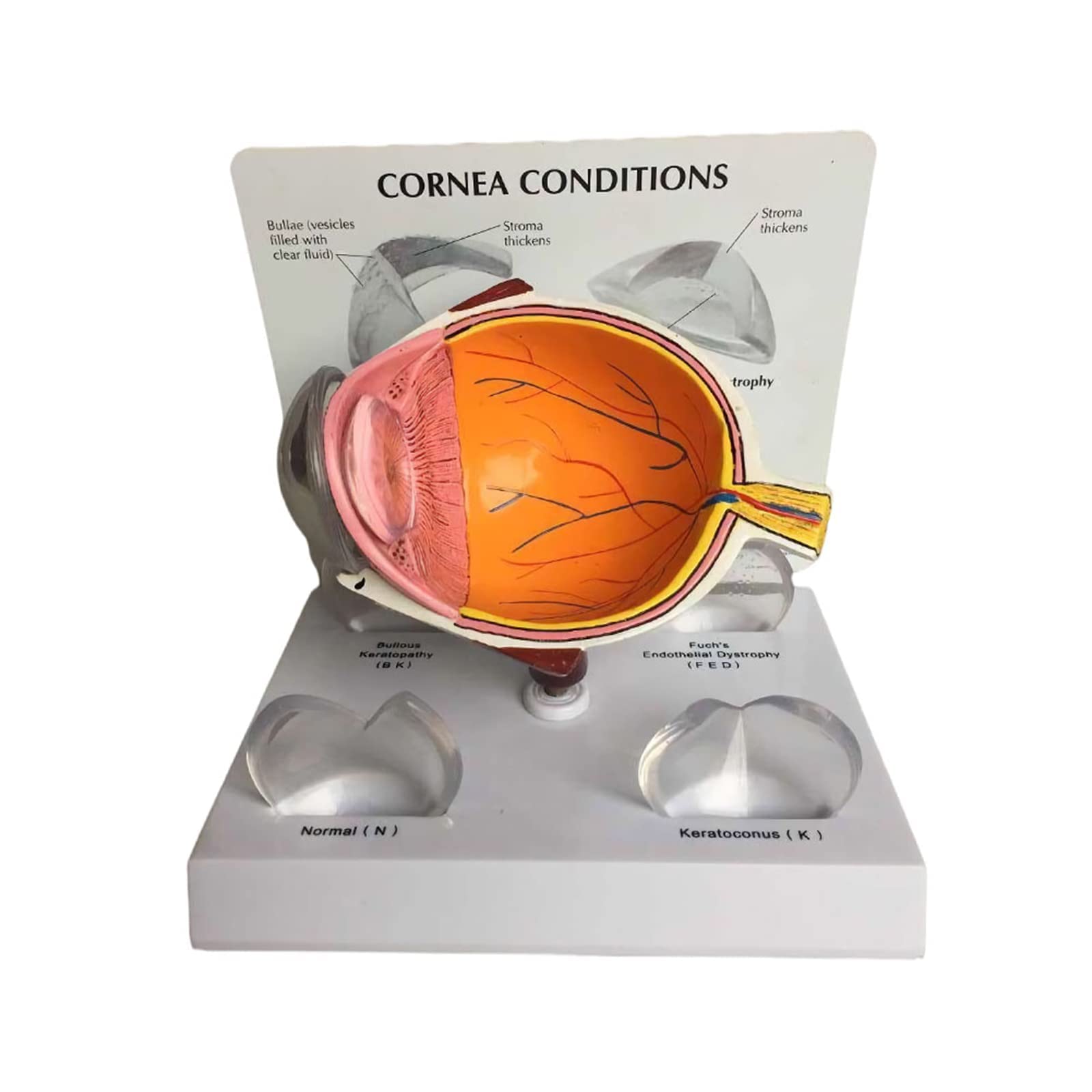 Buy FGVBC Removable Cataract Eye Model, Half Eye Anatomical Model