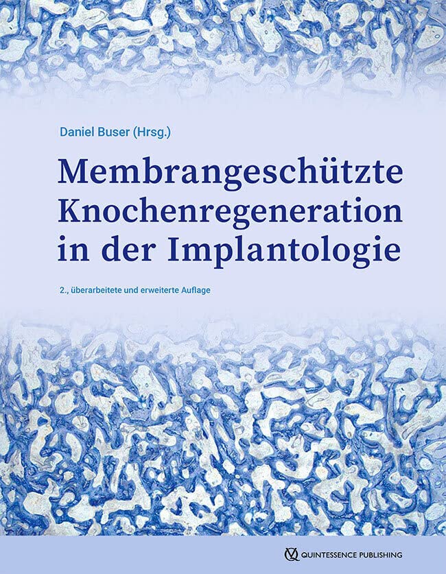 GBR-Technik in der Implantologie: Seit 35 Jahren Fortschritt und neue Anwendungen