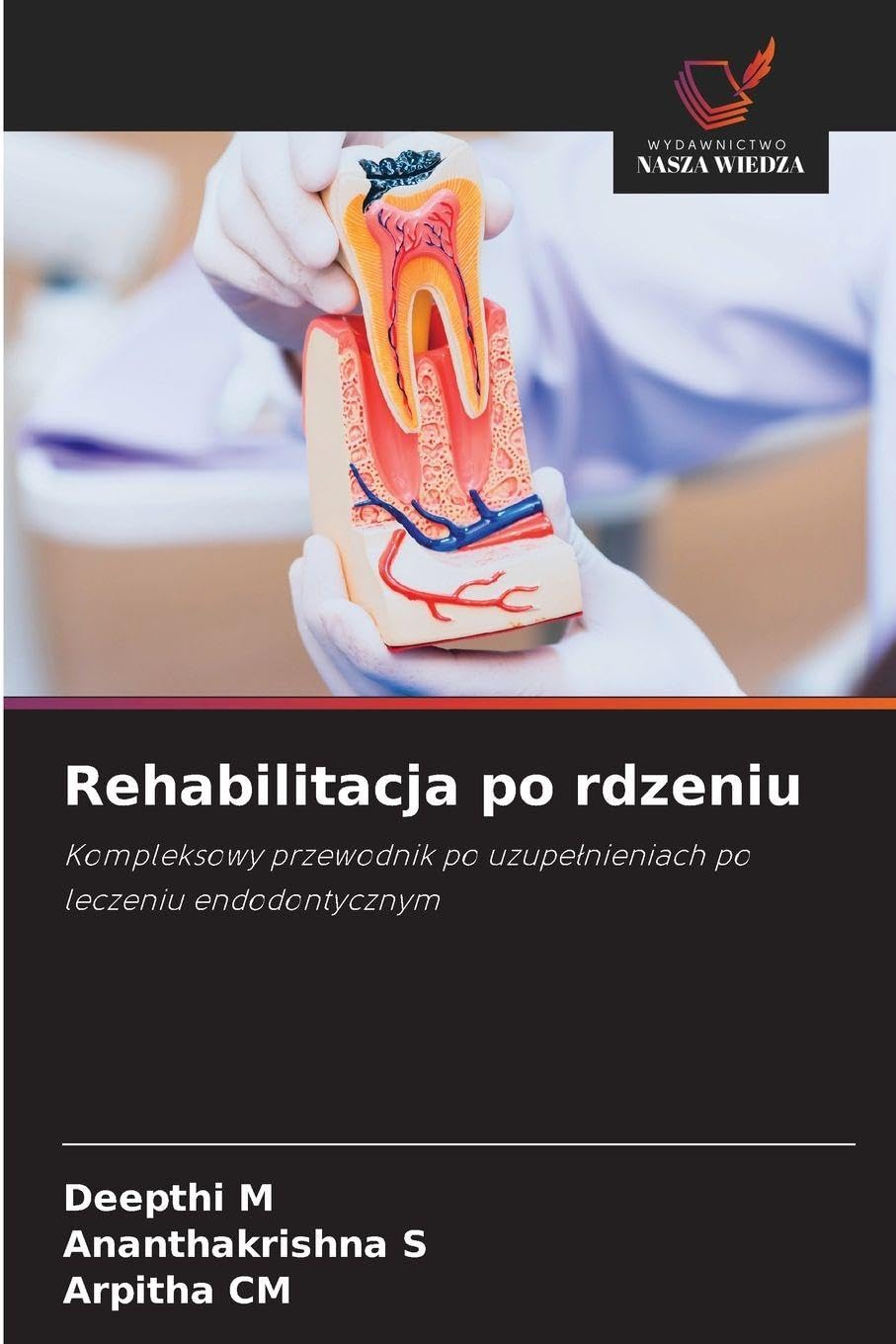 Rehabilitacja po rdzeniu: Kompleksowy przewodnik po uzupe¿nieniach po leczeniu endodontycznym