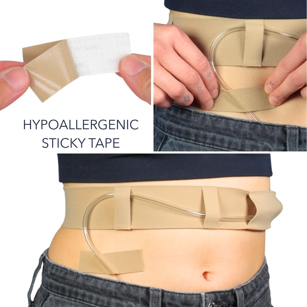 Cintura per tubo per dialisi peritoneale, sottile, morbida ed elastica, sicura per la pelle, prodotta nel Regno Unito, accessori medici per dialisi peritoneale.