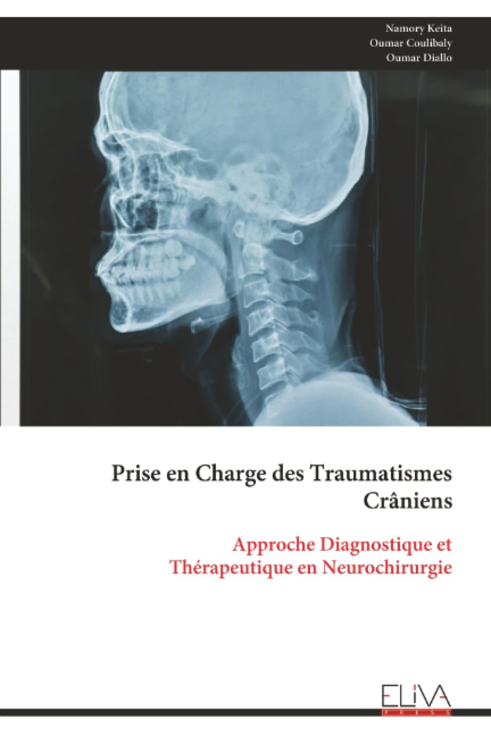 Prise en Charge des Traumatismes Crâniens: Approche Diagnostique et Thérapeutique en Neurochirurgie